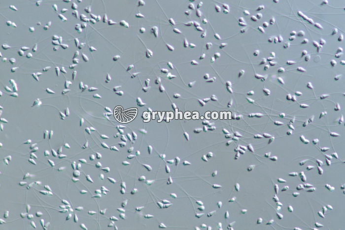 Spermatozoïdes d'Oursin (Paracentrotus lividus) x100 - gryphea.com